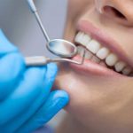 Dental Treatments Clinic in Bandra West