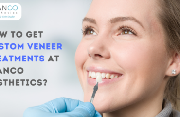 How To Get Custom Veneer Treatments At Blanco Aesthetics?